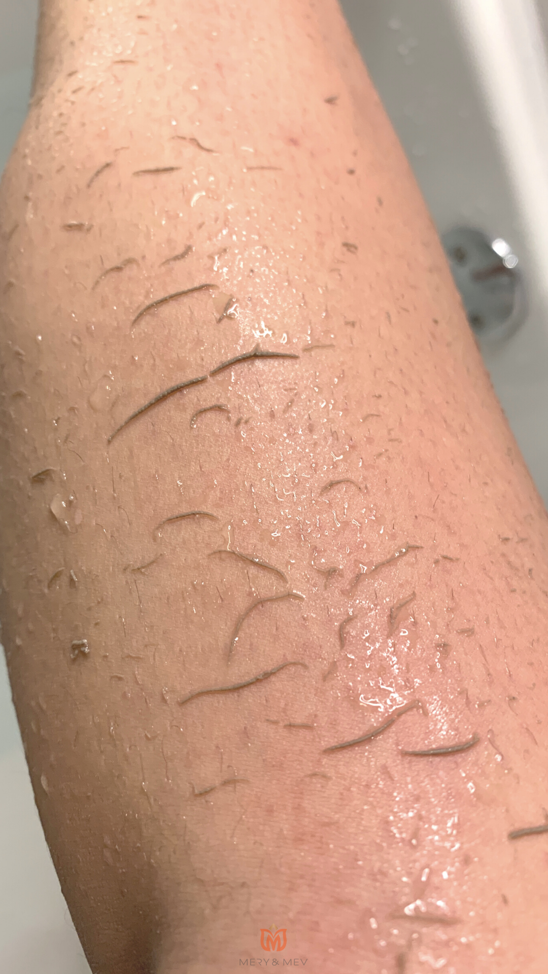 Image of Dead Skin Removed After Exfoliating